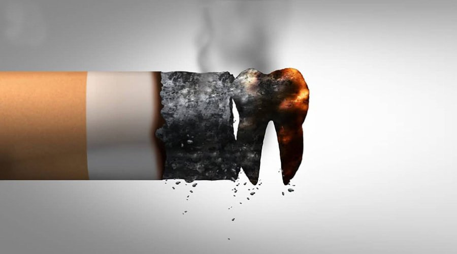 Từ bỏ thói quen hút thuốc lá trong quá trình niềng răng invisalign